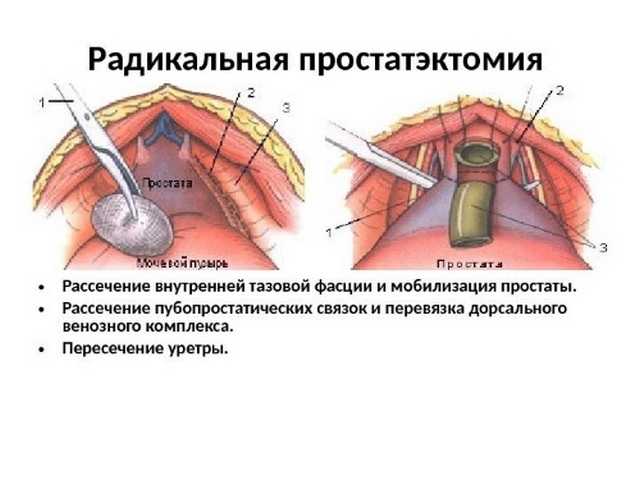 Сколько заживают швы после операции?