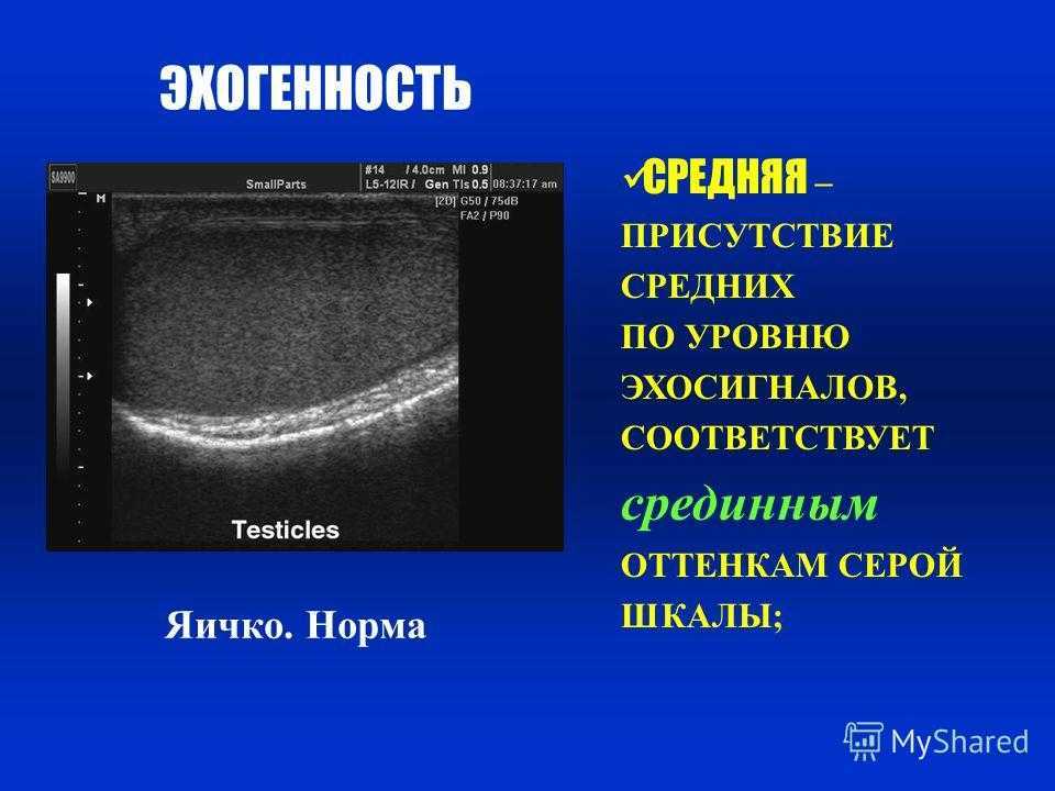 Что такое аваскулярная структура и почему она важна