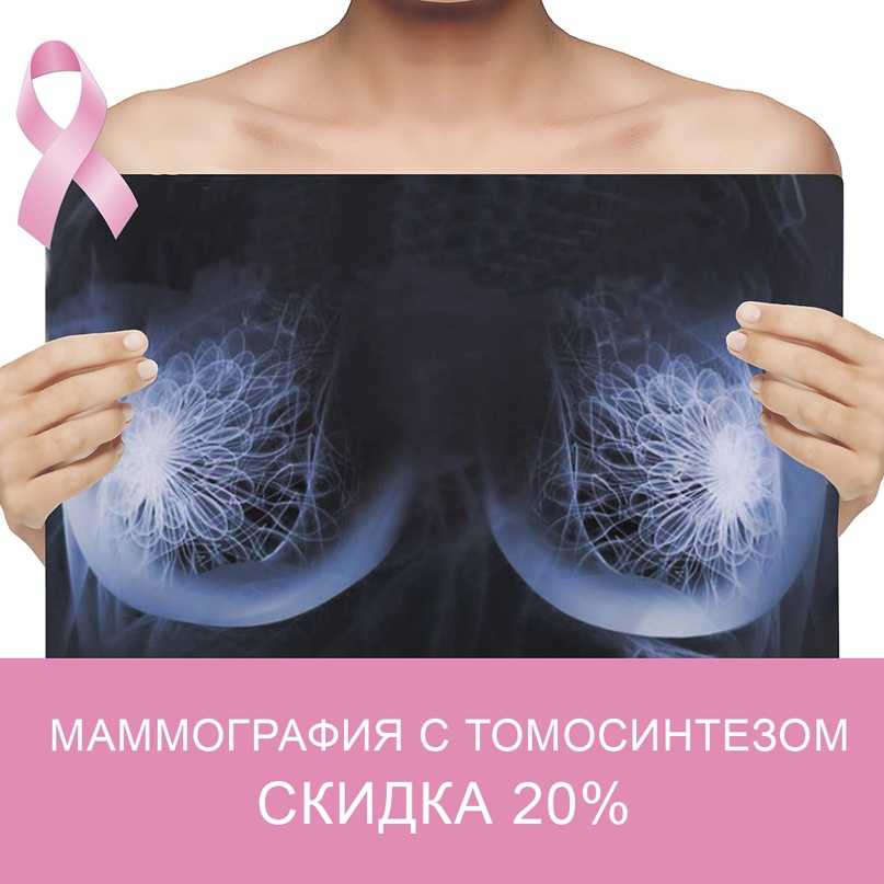 Маммография – необходимое каждой женщине обследование молочных желез