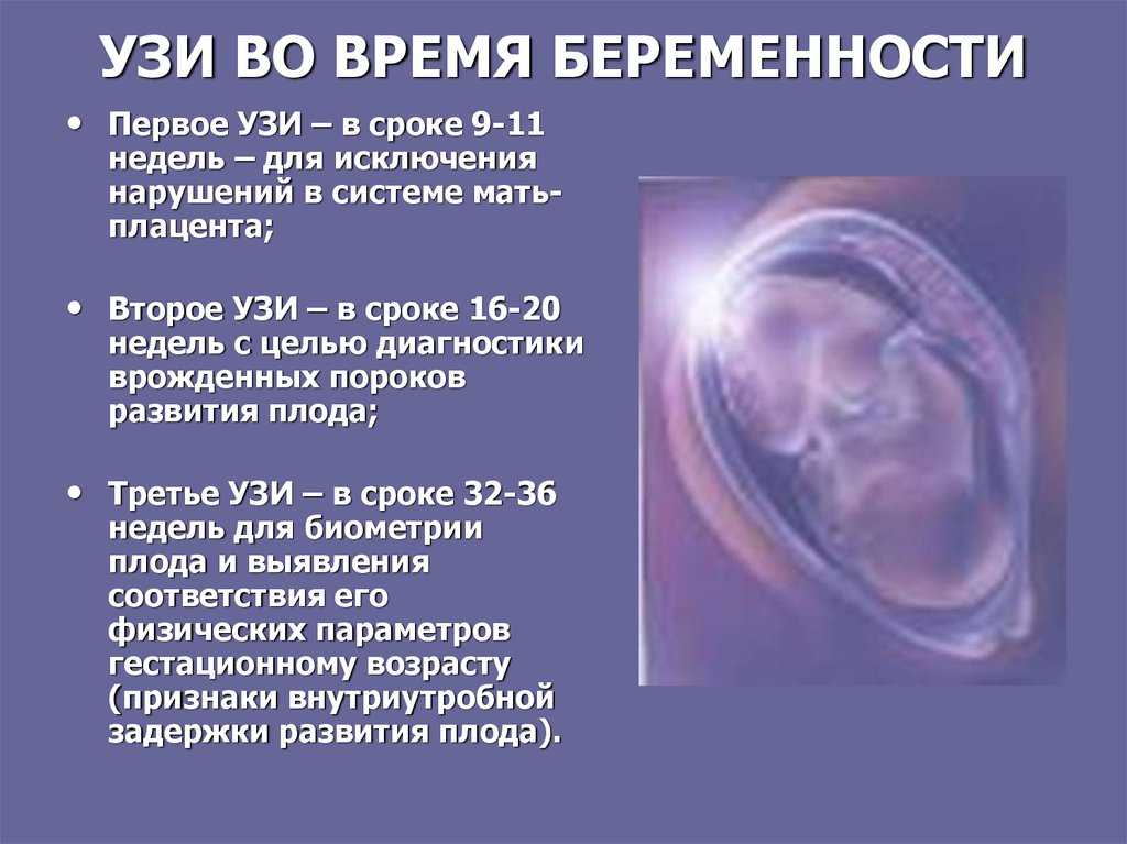 Узи при беременности. узи плода. выявление возможных пороков развития плода