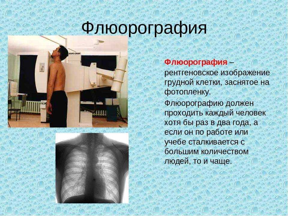 О необходимости флюрографического обследования для каждого — гбуз московской области "долгопрудненская больница"