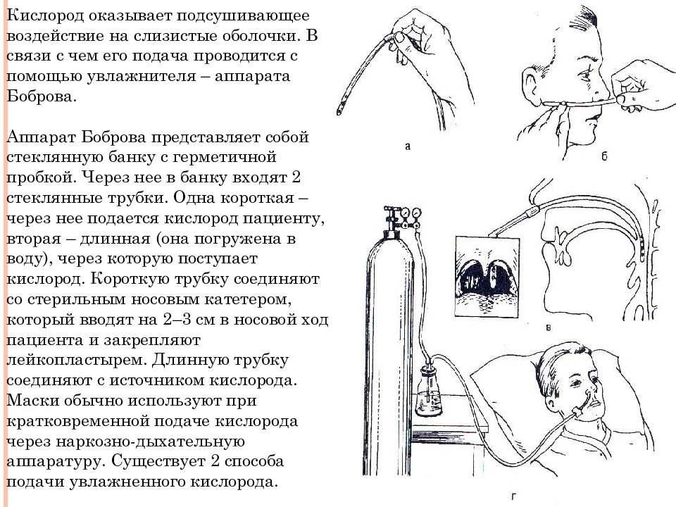 Услуга оксигенотерапия - при каких болезнях и какие врачи назначают
