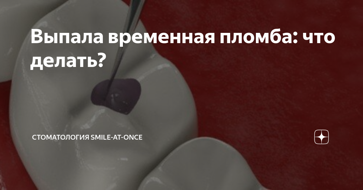 Сонник: выпал зуб, что означает выпадение зубов во сне, значения разных сонников о выпадении зубов