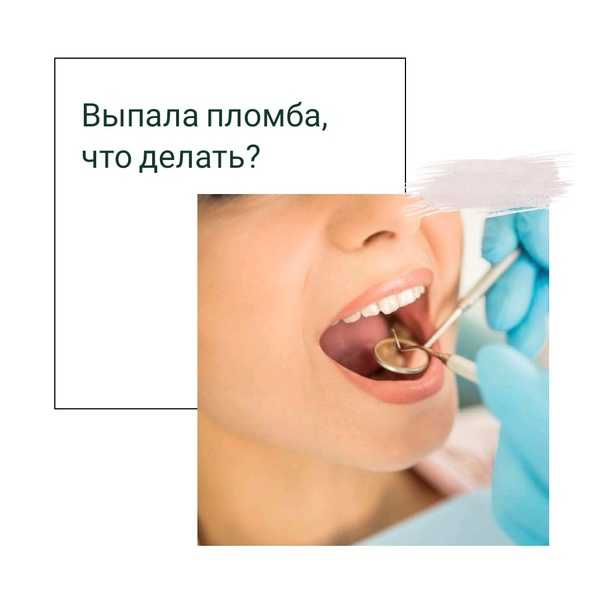 Выпала пломба из зуба 😫💤 снится.ру | самый полный сонник