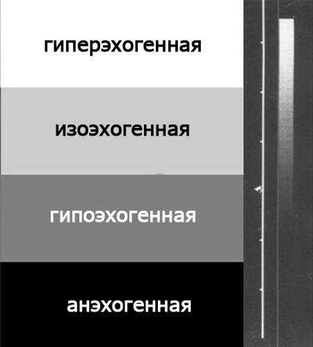 В режиме цдк: аваскулярное. что это значит и как это влияет на организм?