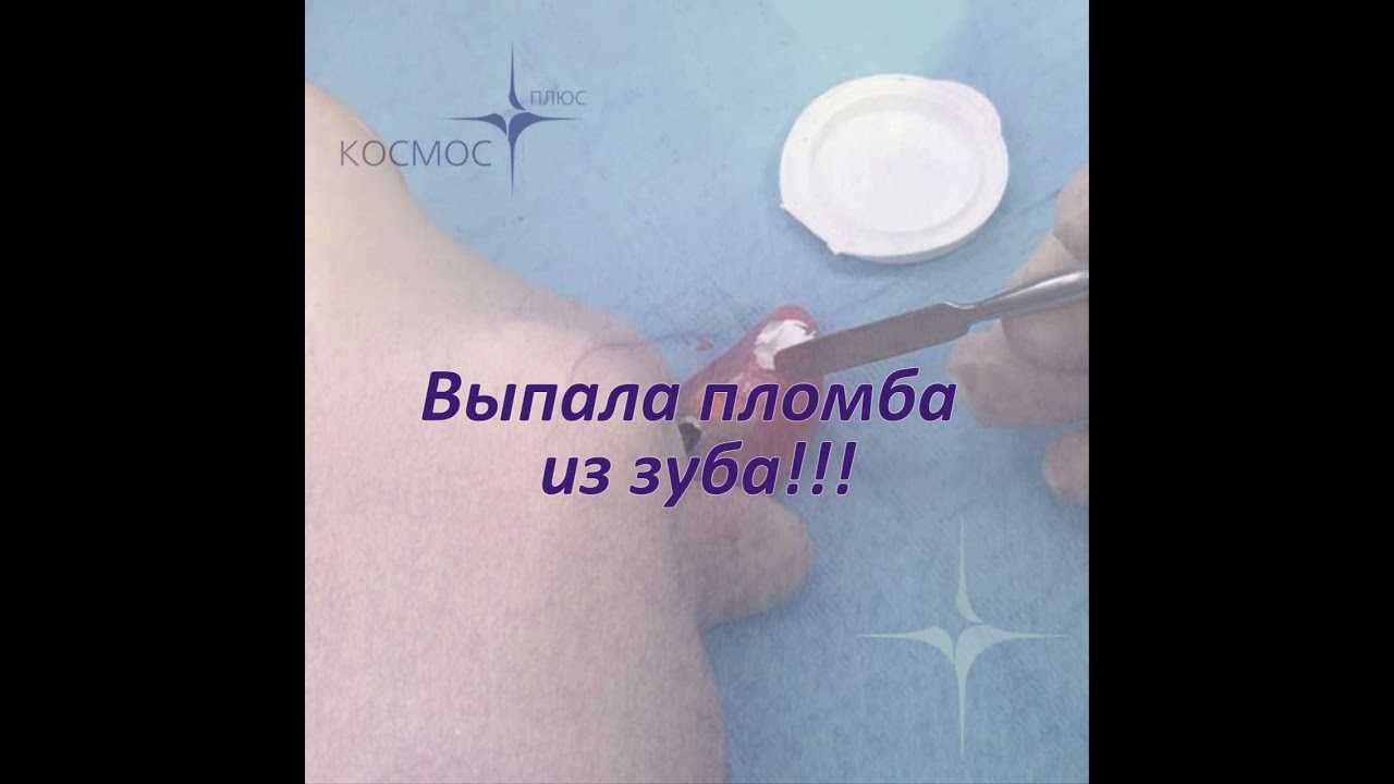 принято считать что выпавший во сне зуб сулит всяческие невзгоды и несчастья но то к чему снится выпала пломба из зуба трактуется по разному в