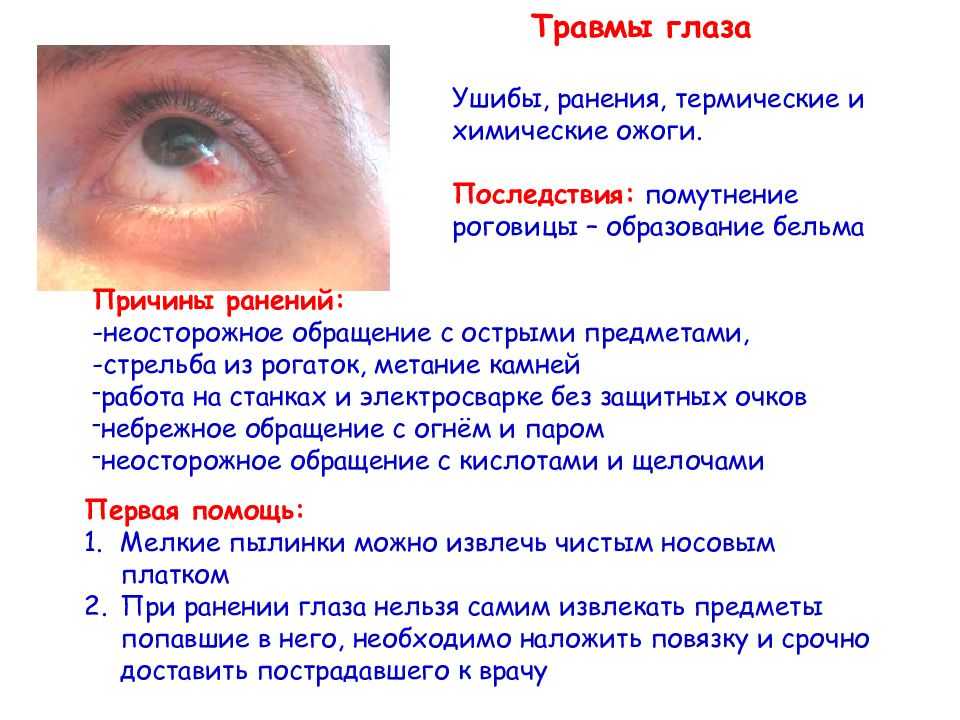 Моргаем каждые 4 секунды. факты о зрении, которые могут вас удивить | здоровье | аиф аргументы и факты в беларуси