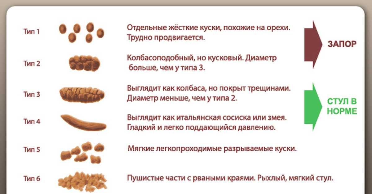 О чем говорит ваш кал: как по форме, цвету, внешнему виду и запаху стула определить болезнь